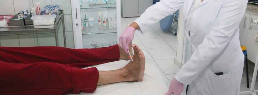 ‘Pés Saudáveis’: Caraguatatuba oferece teste e exame para avaliar sensibilidade dos pés de pacientes diabéticos