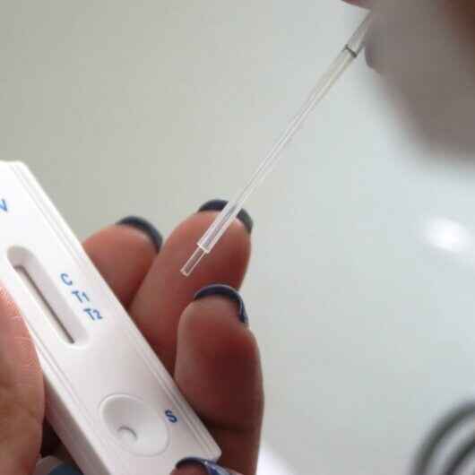 Profissionais de saúde de Caraguatatuba iniciam aula prática para aplicar teste rápido de HIV, Hepatites e Sífilis