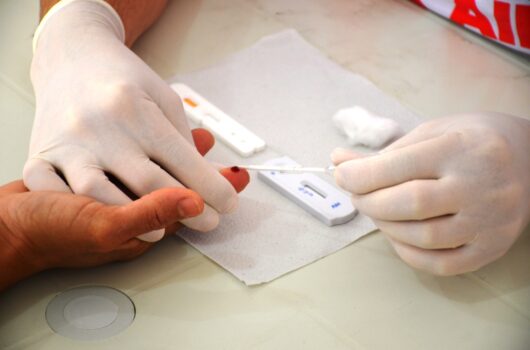 Campanha Dezembro Vermelho em alusão ao Dia Mundial da Luta contra HIV/AIDS inicia nesta sexta-feira em Caraguatatuba Campanha Dezembro Vermelho em alusão ao Dia Mundial da Luta contra HIV/AIDS inicia nesta sexta-feira em Caraguatatuba