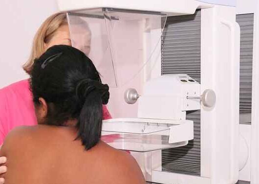 Centro de Especialidades realiza atendimento especial para mamografia no dia 17 de maio Centro de Especialidades realiza atendimento especial para mamografia no dia 17 de maio