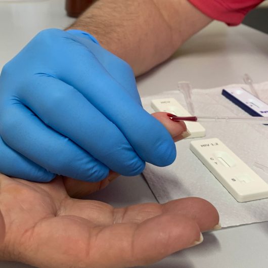 Caraguatatuba reforça campanha Julho Amarelo com orientações sobre hepatites virais e testes rápidos