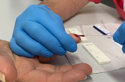 Caraguatatuba realiza testagem gratuita para hepatites virais em ações do Julho Amarelo